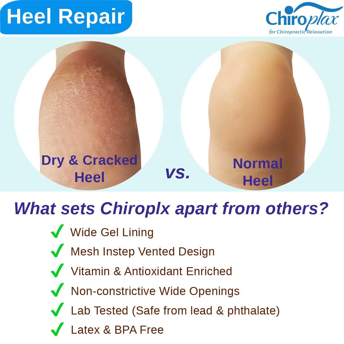 Chiroplax Vented Moisturizing Socks for Dry Cracked Heels Feet Treatment Gel Lined Spa to Repair Heal Soften Calluses Overnight, 2 Pairs (Gray)