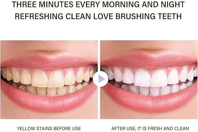 Probiotic Whitening Toothpaste, Utogur Toothpaste, Niacinamide Whitening Toothpastes, Effectively Whitens Teeth, Natural Gentle Remove Tooth Stains (2)