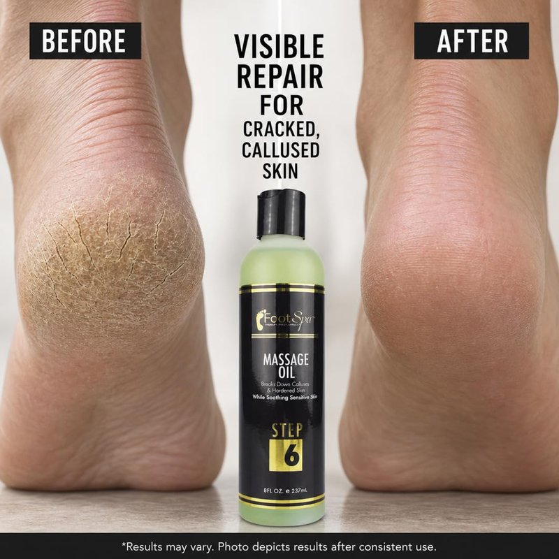 Foot SPA Pedicure Massage Oil – Tea Tree, Peppermint & Eucalyptus Blend for Callus Softening & Cracked Heel Repair | Cooling Relief | Professional Salon & At-Home Use | 8 oz