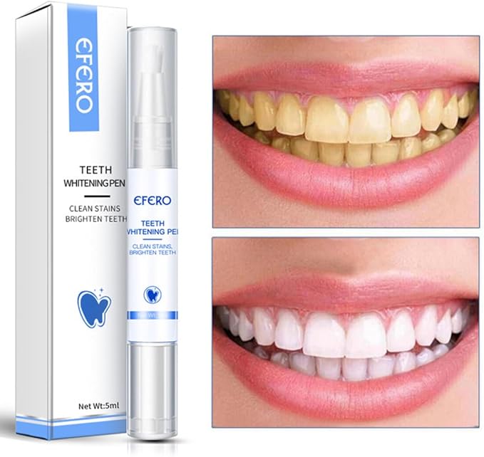 Teeth Whitening Teeth Whitening Gel Pen Essence for Tooth Instant Polish White Style1, Pen