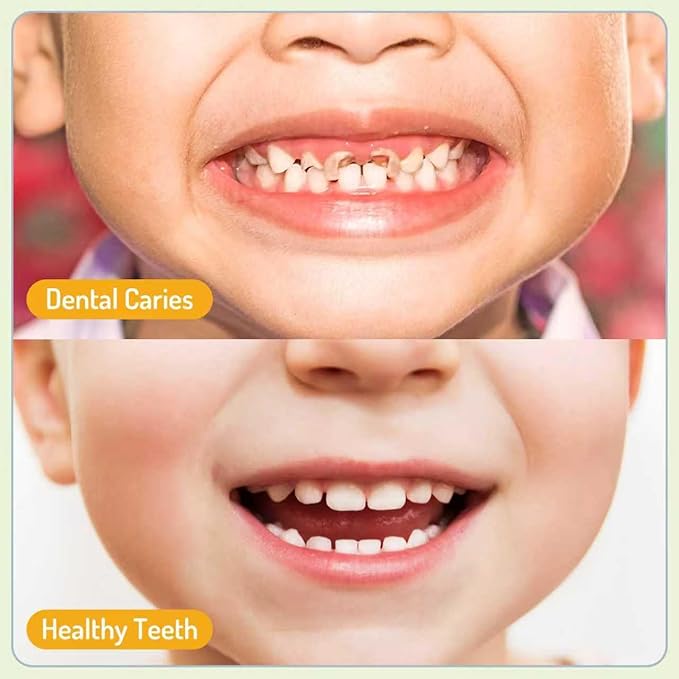 PEGO Kids Oral Spray, Toddler Toothpaste Helper for Cavity Prevention and Fresh Breath, Children Anticavity with Fluoride Free for Newborn to Preschoolers, Kid's Mouth Spray (40ml*2, Peach)