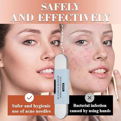 Medical Grade Blackhead Extraction Tool Kit - Blackhead Remover Tool Comedones Extractor Acne Removal Kit for Blemish - Whitehead Popping - 7 Pcs Set Removing for Nose Face Tools (Content 7-Piece Set)