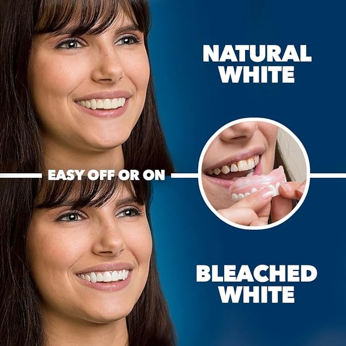 Imako Premium Cosmetic Uppers - 1 Pack - Large, Bleached White - DIY Smile Makeover - Made in USA