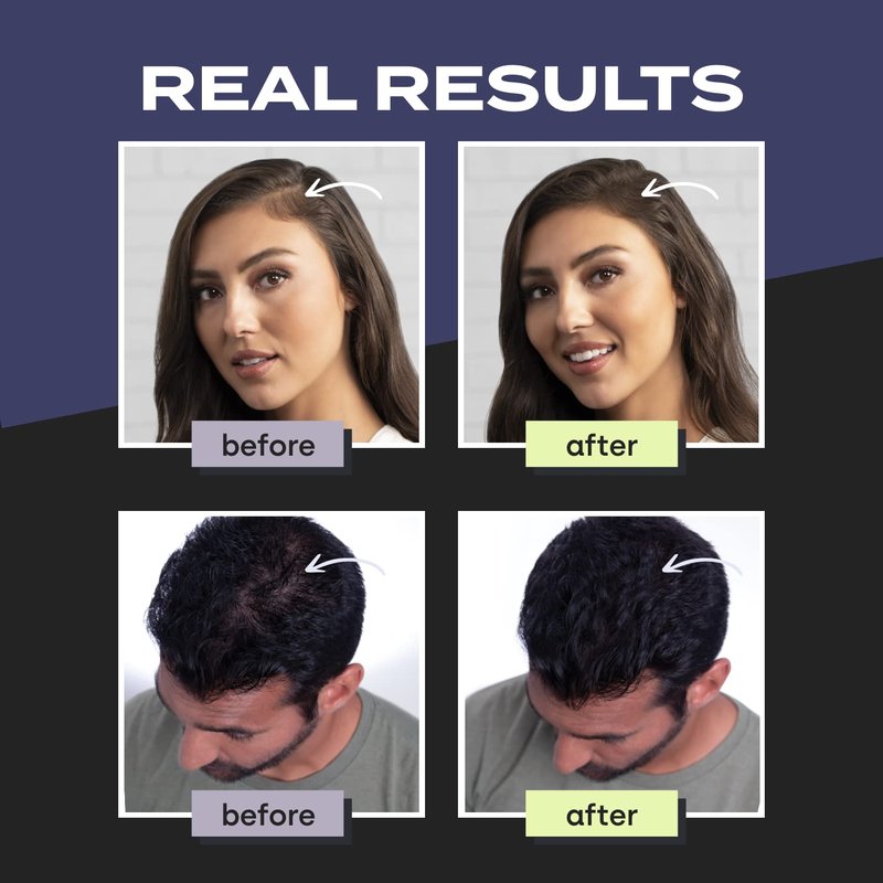 Toppik Hair Building Fibers, Gray, 0.11 oz Fill In Fine or Thinning Hair, Instantly Thicker, Fuller Looking, 9 Shades for Men & Women, Keratin Protein Formula