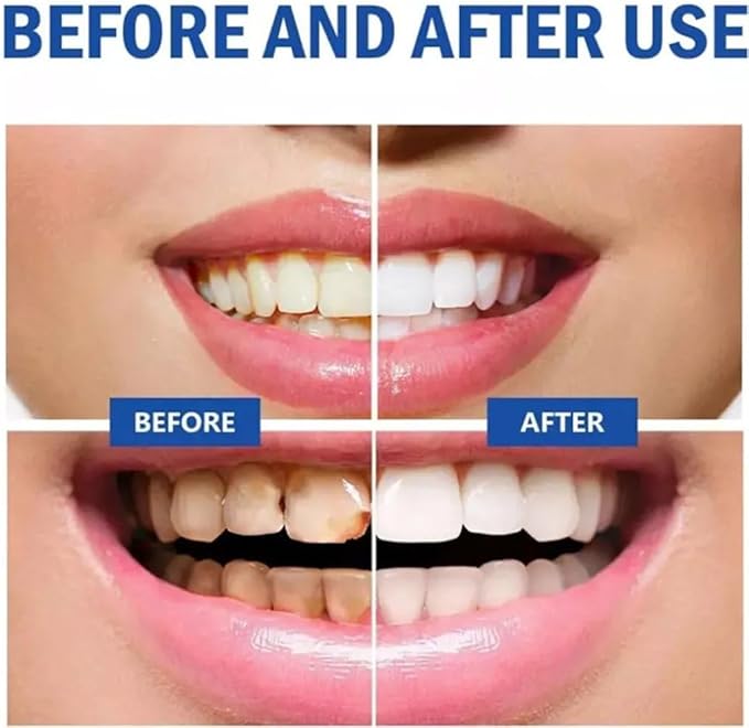 SP 10 Probiotic Whitening Toothpaste, Natural Oral Care with Probiotics for Whiter Teeth, Fresh Breath & Gum Health