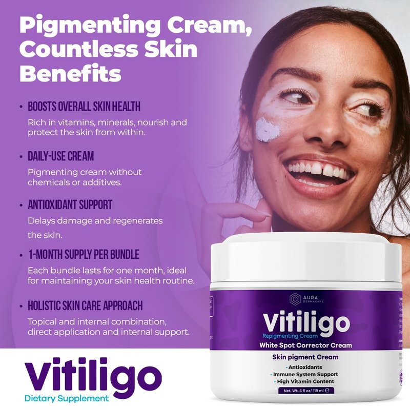 Vitiligo Cream for White Spots (4oz) - Repigmenting Cream with Polypodium Leucotomos and Melanocyte Support - Evens Skin Tone and Reduces Discoloration by Aura Dermacare
