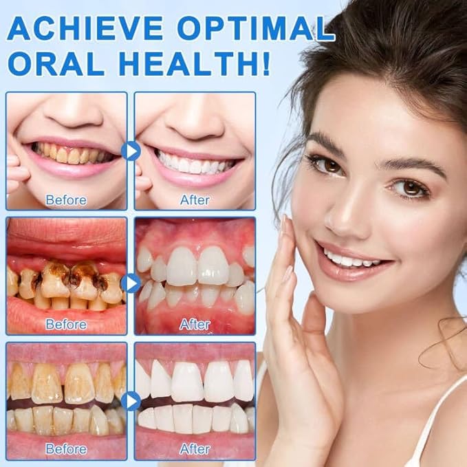 Hydroxyapatite Toothpaste, Enamel Repair & Cavity Prevention - Fresh Mint Flavor, Fluoride-Free, Whitening, Fresh Breath for Daily Use 1Pack