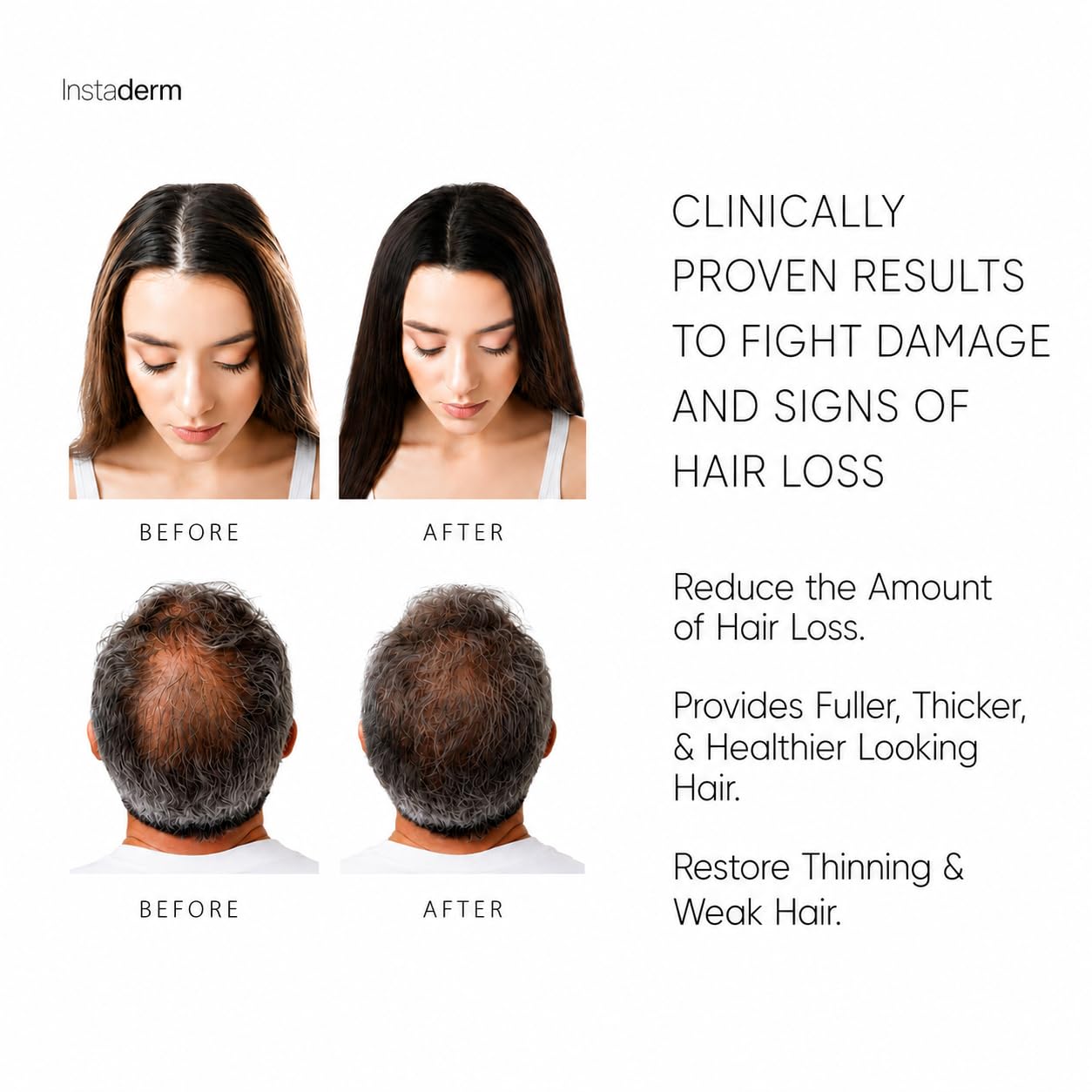 Hair Growth Serum – Peptide & Botanical Scalp Treatment for Thinning Hair – Supports Fuller, Stronger, Healthier-Looking Hair – Lightweight Daily Serum for Men & Women