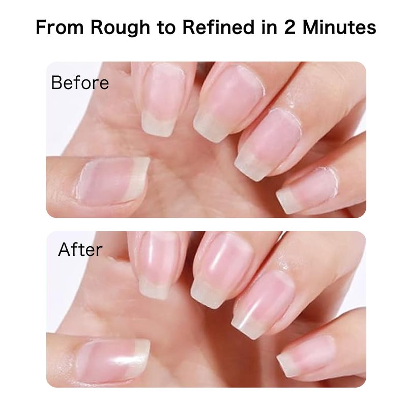 Cuticle Remover Liquid, Instant Cuticle Softener for Dry Damaged Nails - No Tool No Soaking Required, Moisturizing & Repair Formula, 0.5 Fl Oz