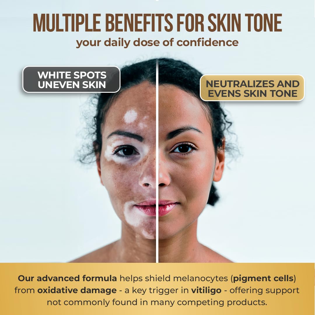 Dermawonder Vitiligo Capsules (60 Count) Effective Vitiligo Supplement, Reduce White Spots & Improve Skin Pigmentation Support, for All Skin & Reduce White Spots on Skin and Tinted Skin
