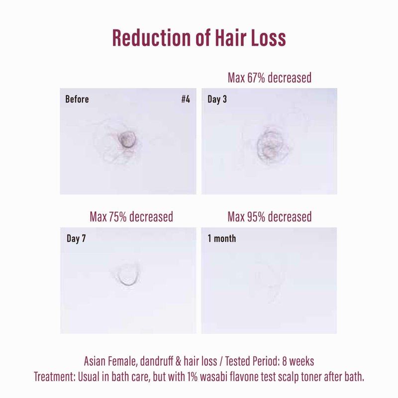 Moist Diane Hair Thickening Shampoo for Thin Hair, Anti Thinning Shampoo for Women & Men, Japanese Paraben& Sulfate Free SHAMPOO with Keratin, Argan Oil& Biotin, VOLUME& SCALP 15.2 Fl Oz 2 Count