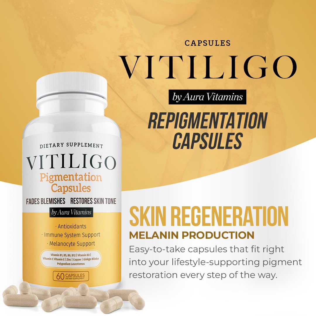 Dermawonder Vitiligo Capsules (60 Count) Effective Vitiligo Supplement, Reduce White Spots & Improve Skin Pigmentation Support, for All Skin & Reduce White Spots on Skin and Tinted Skin