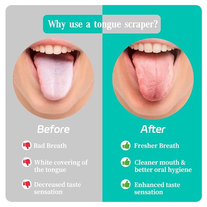 VIWIK Tongue Scraper for Adults, 100% Stainless Steel Tongue Cleaner - 6 Pack Hygienic Oral Care Tools, Bad Breath Remover & Tongue Brusher for Family Dental Hygiene Kit