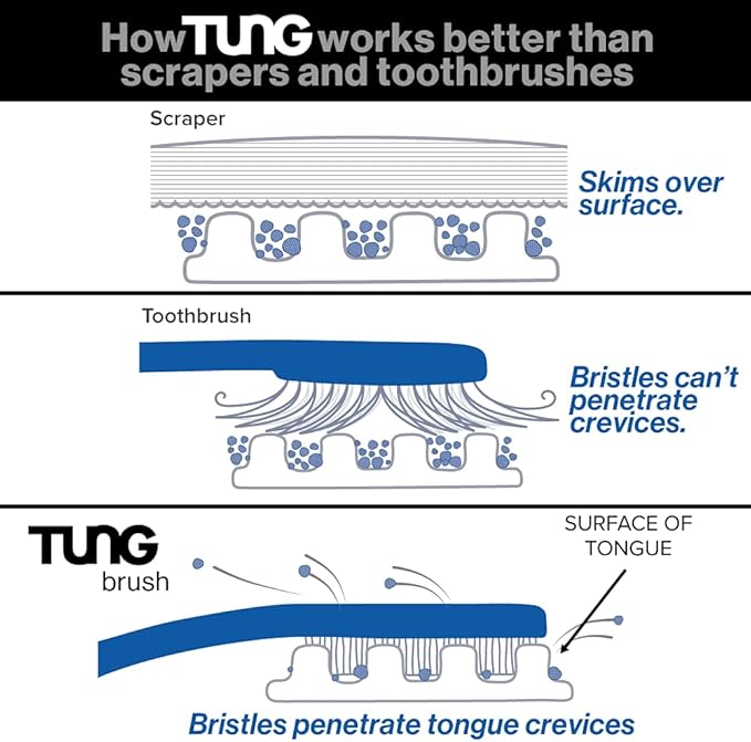 Peak Essentials | Tung Tongue Gel | Fresh Mint Tongue Cleaning Paste | Bad Breath and Halitosis | Mouth Odor Eliminator | Use with Tongue Brushes & Scrapers | Made in America (1 Pack)