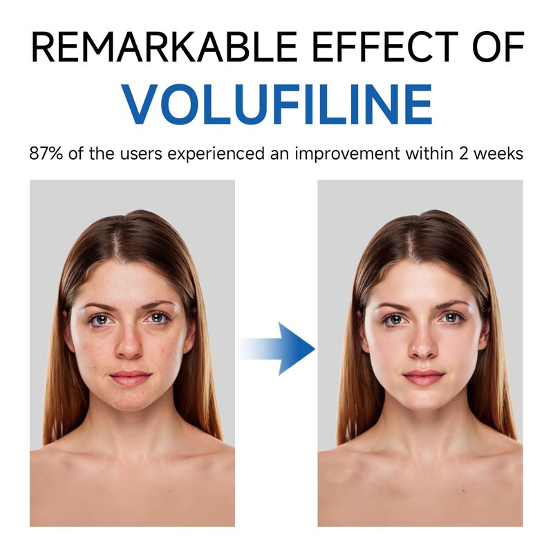 Volufiline Serum, Volufiline Under Eye Serum, Cosmetic Grade Ampoule for Skin Elasticity Improvement, Face & Body Fine Lines, Hydrating Texture, 10ml*2