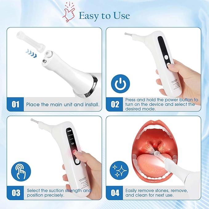 Upgraded Electronic Tonsil Stone Remover,lectronic Oral Care Cleaning Tool Set with 3-Speed Vacuum, 4 Soft Silicone Nozzles & LED Light for Fresh Breath & Comfortable Use (White)