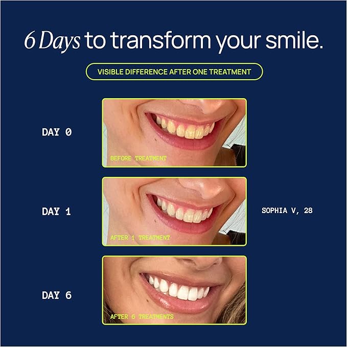 Laughland Super Strength Teeth Whitening Gel 3 Pack, Tooth Whitener, 11% Hydrogen Peroxide, Glycerin, Aloe Vera & Mint, at Home Dental Care, Travel Friendly, 6 Treatments