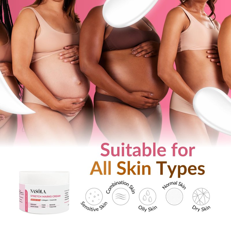 Nasola Stretch Mark Cream for Pregnancy, Eliminate and Prevent Deep Stretch Marks, Moisturizer Belly Cream for Pregnancy and Scars Removal With Enriched Collagen and Ceramide, 4.23 Oz