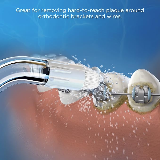 Replacement Tips for Waterpik Water Flosser (6 Orthodontic Tips)