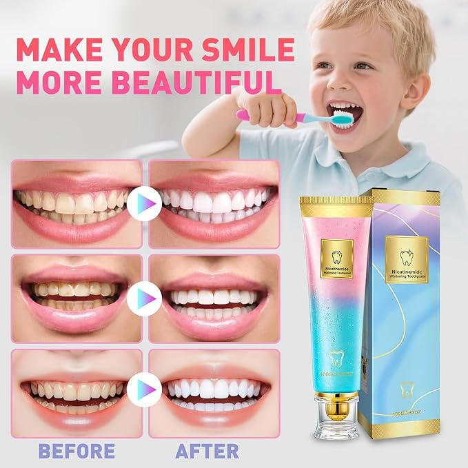 2Pcs Niacinamide Whitening Toothpaste, Bright White Toothpaste for Fresh Breath, Nicotinamide Dazzling White Toothpastes, Removal Tooth Stains, Complete Care Dazzling White Toothpastes
