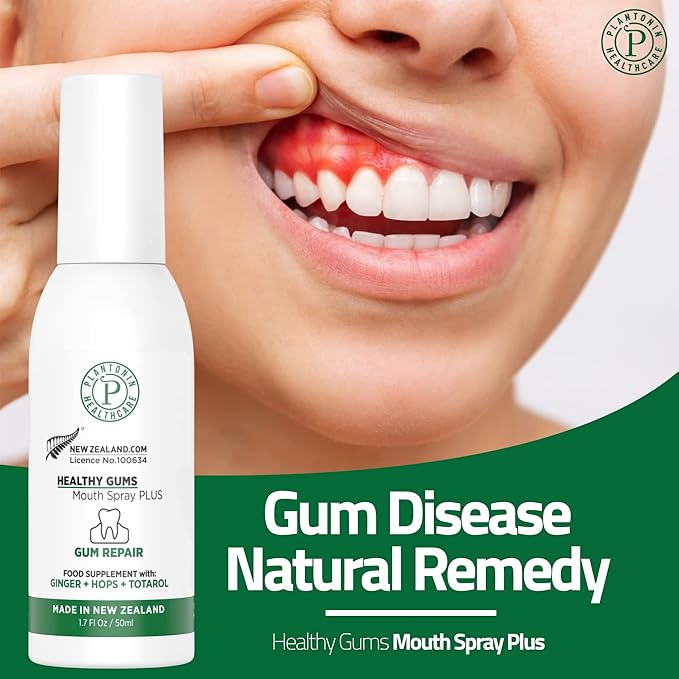 Oral Rinse Spray for Gum Disease and Gingivitis Treatment for Adults - 50ml 142 Servings - Alcohol Free Natural Alternate of Toothpaste with Ginger and Totarol - Bleeding Gums Treatment