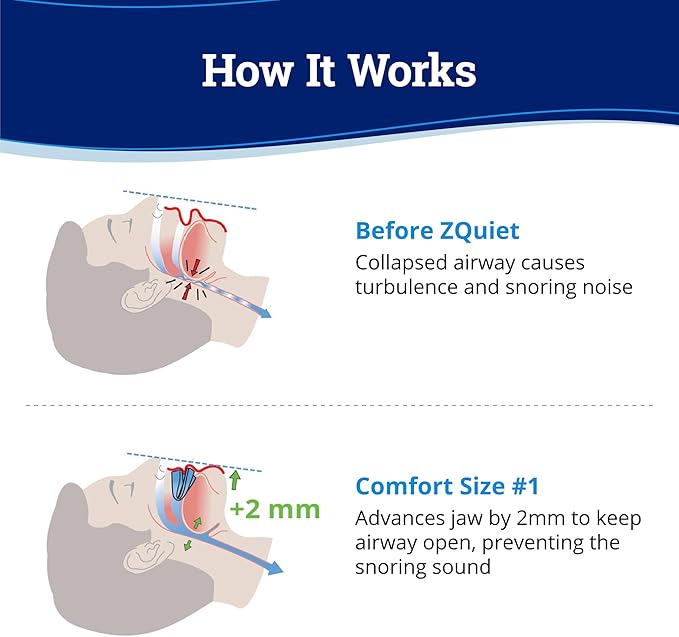 ZQuiet Anti-Snoring Mouthpiece Solution - Comfort Size #1 (Single Device) + Cleaner (1.5oz Bottle) - Made in USA Snoring Solution for a Better Night’s Sleep (Blue)