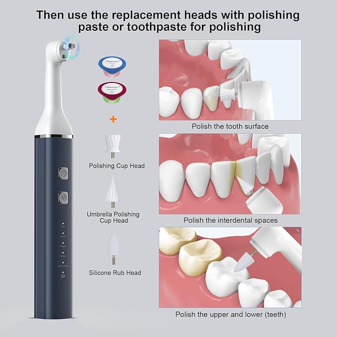 Tooth Polisher and Plaque Remover, Teeth Cleaning Tools for Cleaning and Polishing of Tooth, Dental Cleaning Tools for Brighten and Polish Teeth with 5 Brush Heads, 4 Speed Modes and 3 Polish Pastes