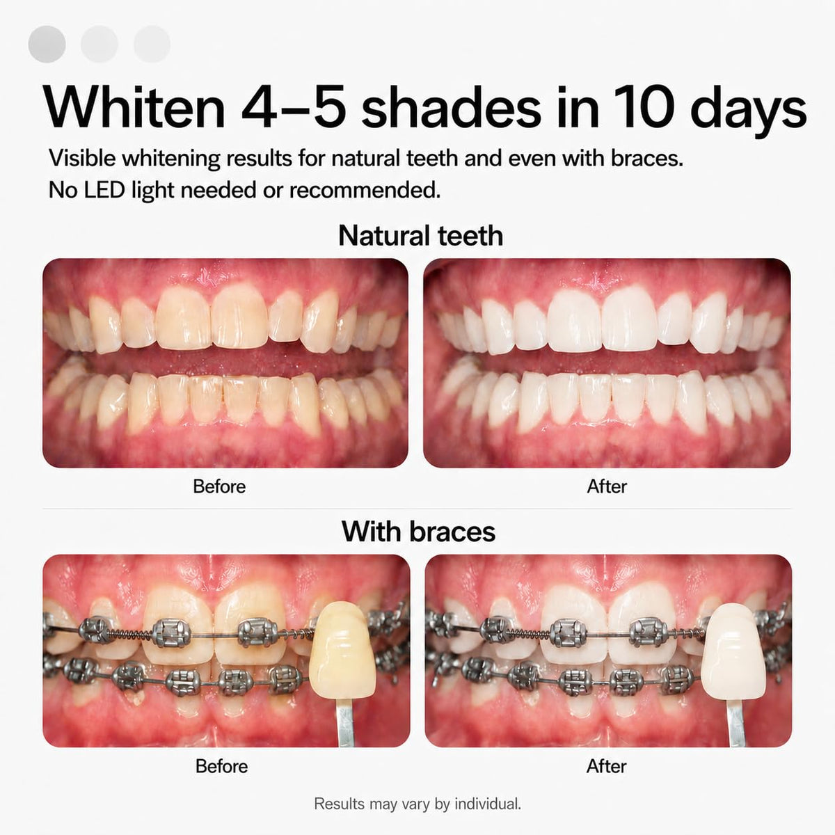Opalescence GO 15 Whitening Bundle - (7 Treatments) Hydrogen Peroxide Prefilled Teeth Whitening Trays and Travel Original Whitening Toothpaste 1 Oz - Mint Flavor - 6238-1