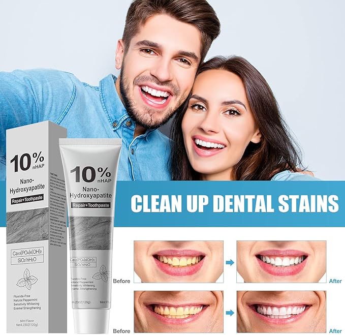 2 Pcs 10% Hydroxyapatite Toothpaste, Nano-Hydroxyapatite Toothpaste for Advanced Enamel Protection,New Upgraded Formula,Gentle Mint,Fresh Breath