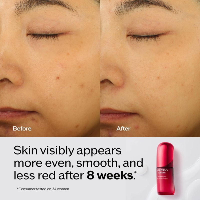 Shiseido Smooth & Hydrate Eye Care Set - Clarifying Cleansing Foam (15mL), Ultimune Power Infusing Serum (10mL), Benefiance Wrinkle Smoothing Cream (30mL) & Eye Cream (15mL) - $145 Value