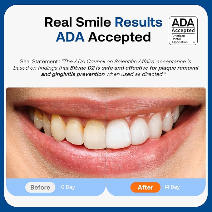 Bitvae Ultrasonic Electric Toothbrush for Adults and Kids, ADA Accepted Travel Toothbrush with Rechargeable 60-Day Battery Life, 5 Modes, 8 Heads, Case, Holder, Frost White