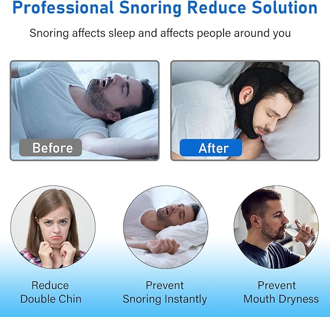 Forzacx Chin Strap for Cpap Users Anti Snoring Devices 2 Pack - Breathable Cpap Chin Strap Snoring Solution, Effectively Reduce Snoring, Non-Stick Hair, Don't Fade - Black