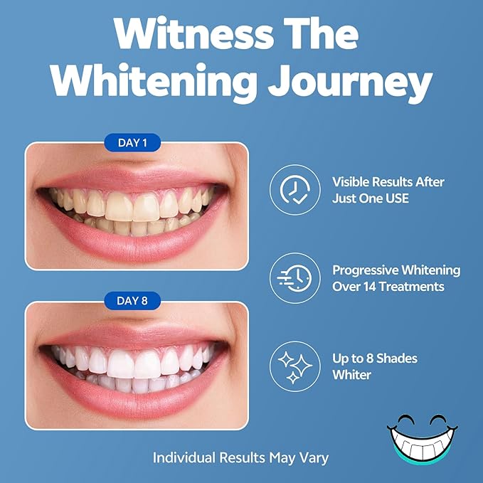 Teeth Whitening Strips, 14-Day Treatments Clinically Proven for Visible & Affordable Teeth Whitening, Enamel Care Whitening, Reduced Sensitivity Formula, Mint.
