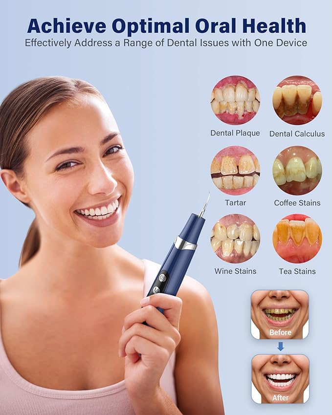Plaque Remover for Teeth - Tartar Remover for Teeth with LED Light & 5 Modes, Rechargeable Hard Plaque Remover with 2 Replaceable Heads, Ultrasonic Teeth Cleaner Kit for Home Use