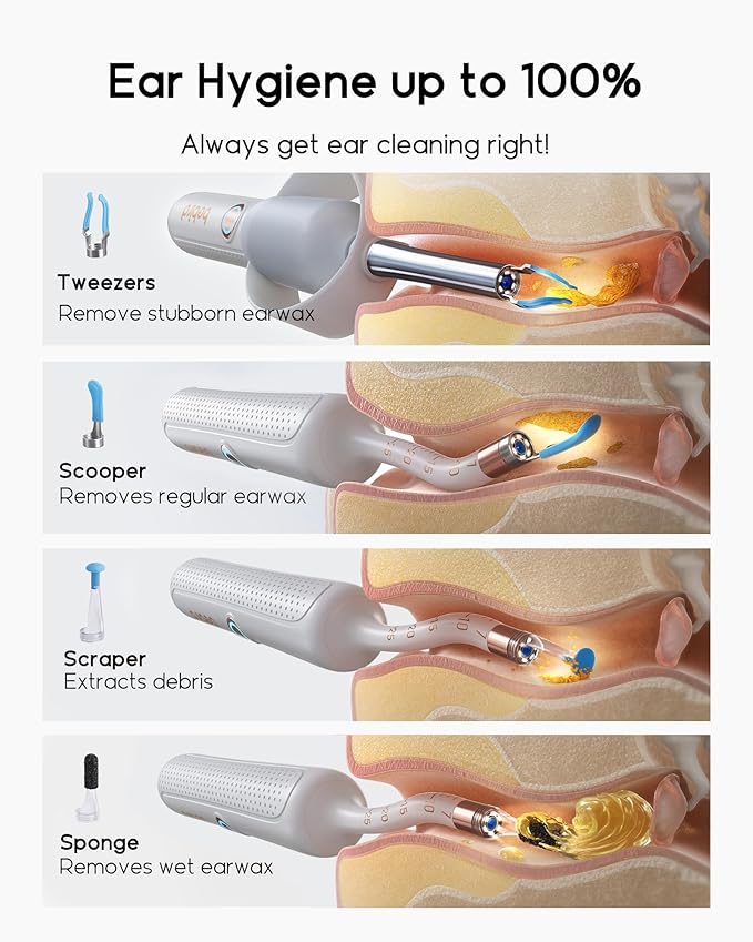 Bebird Earsight Plus R37R Ear Cleaning Camera Wax Removal Tool kit, Flexible Earwax Cleaner Scope Otoscope Cam Light, Visual Earpick Tweezers Wireless Ear-Wax Remover for Adults & Kids - White