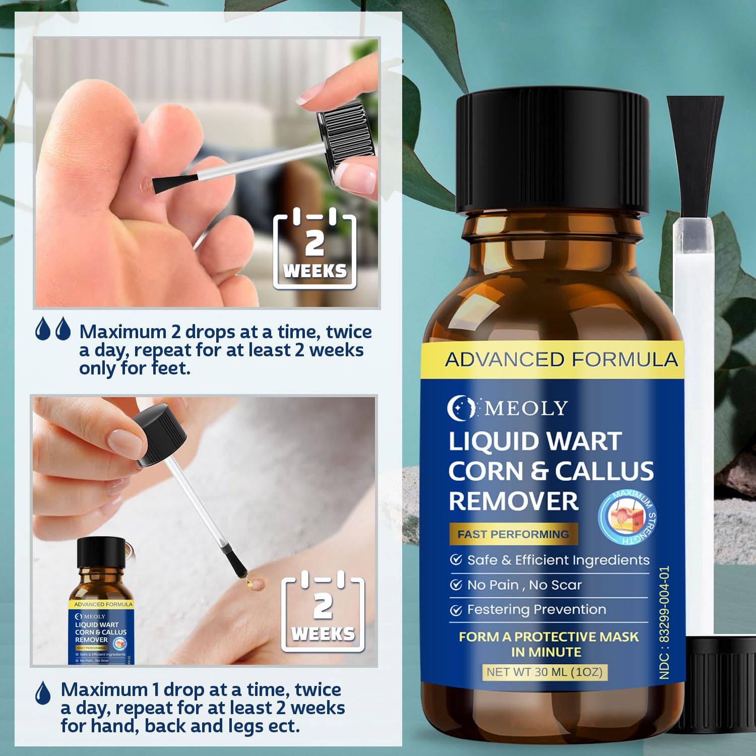 MEOLY Fast-Acting Wart Remover: Salicylic Acid Wart Remover for Plantar Wart, Corn Fast-Acting for Men and Women 30 ML