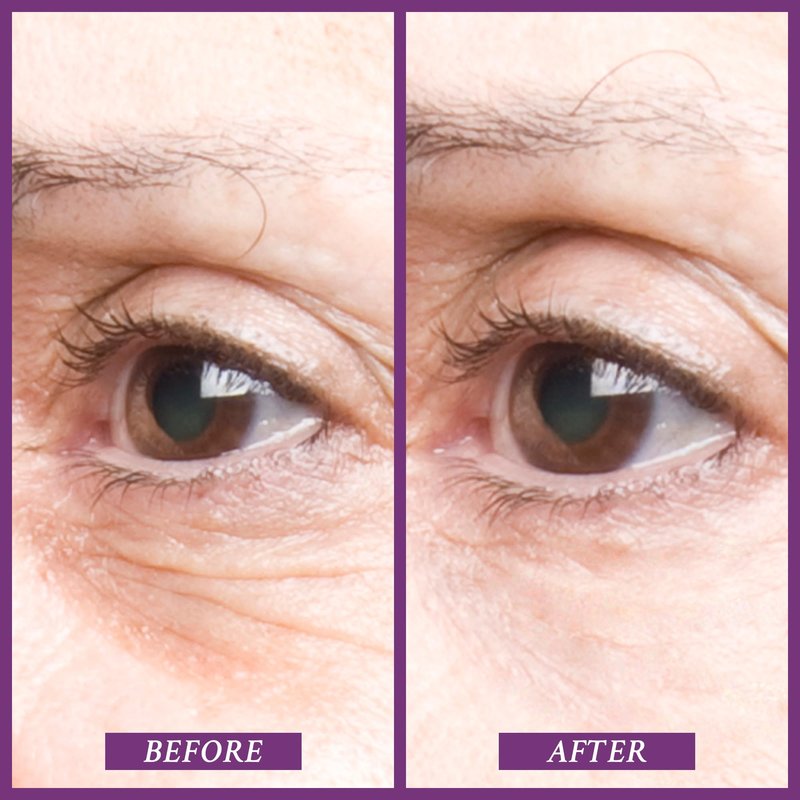 PRAI Beauty Ageless Eye Tight Uplift Serum, Anti-Aging and Hydrating Eye Serum, For Instantly Ageless Brow and Eyelid Area, 0.5 Oz