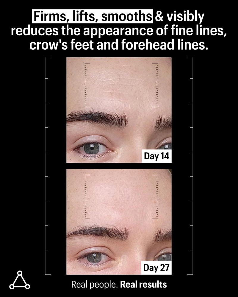 Allies of Skin Multi Peptides & Growth Factor Collagen Boosting Face Serum | Skin Tightening Anti-Aging Complex with 9% Peptides| Firms Sagging Skin & Visibly Reduces Wrinkles (1 oz)