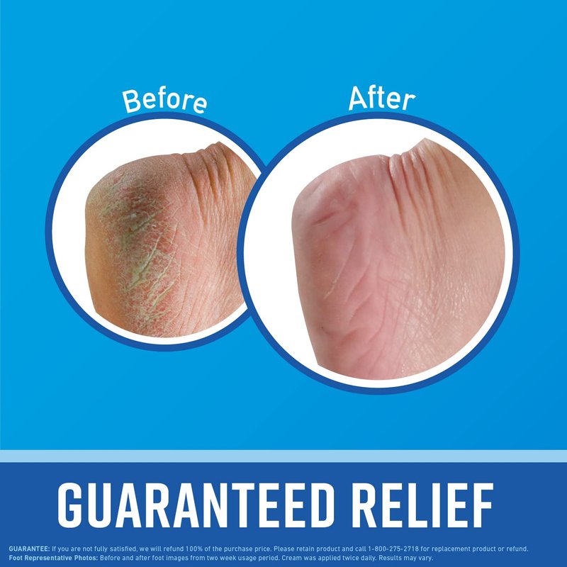 O'Keeffe's for Healthy Feet Foot Cream; Guaranteed Relief for Extremely Dry; Cracked Feet; Instantly Boosts Moisture Levels; 3.2 Ounce Jar; (Pack of 3)