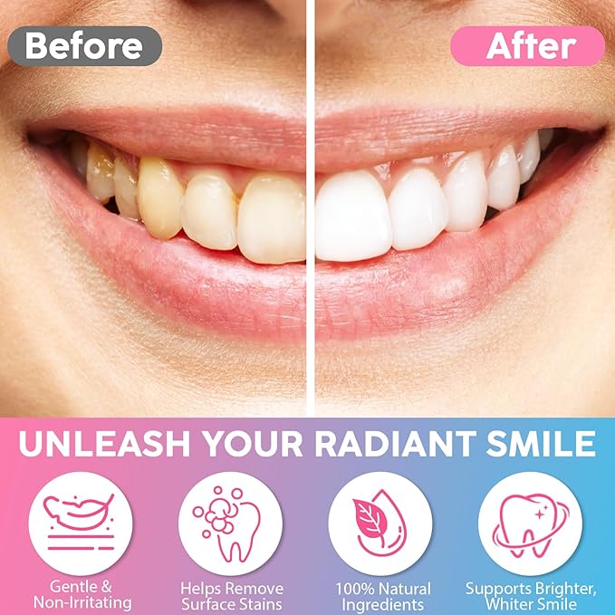 Niacinamide Whitening Toothpaste, Complete Care Toothpaste，Remove Tartar,Remove Tooth Stains,Protects Tooth Enamel,Fresh Breath(3.8 Fl Oz (Pack of 2))