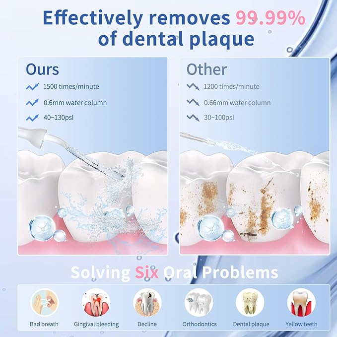 Water Flosser with Camera for Teeth, VITCOCO Visual Water Dental Flosser with 12-Gear, Rechargeable Water Flosser with 3-Nozzle and IPX7 Waterproof for Android and iOS(White)