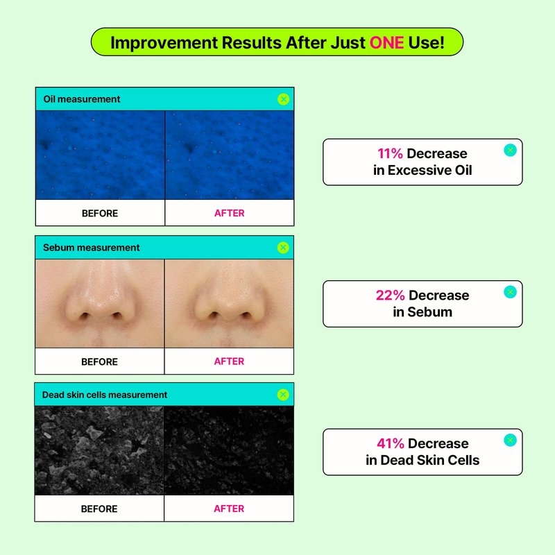 EDIT.B Calming Tok Cica Heartleaf Trouble Pads, Cooling & Hydrating Facial Toner Pads for Sensitive Skin, Mild Exfoliating & Soothing, Easy-Split for Multi-Use, Daily Korean Skin Care (70 Sheets)