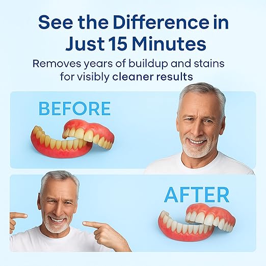 Ultrasonic Denture & Retainer Cleaner – 42 kHz Deep Clean, 200 ml Tank, 5-Min Timer – for Dentures, Aligners, Night Guards, Mouth Guards – Compact Non-Removable Tank Design – iSonic F3900