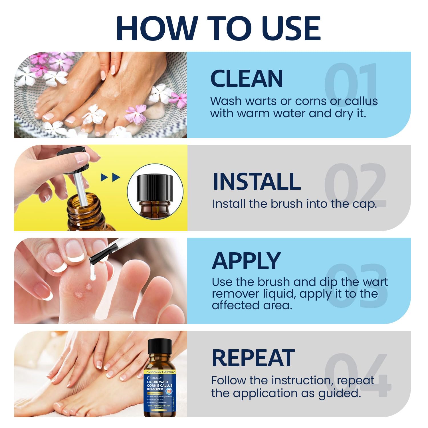 MEOLY Fast-Acting Wart Remover: Salicylic Acid Wart Remover for Plantar Wart, Corn Fast-Acting for Men and Women 30 ML