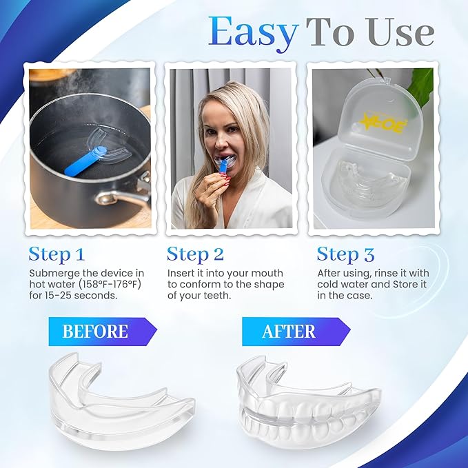2-Pack Dual-Mold Bruxism Night Guards, Premium Comfort for Teeth Grinding & TMJ Relief (Clear & Blue), BPA & Latex-Free, Custom Dental Guards, Travel Cases & Brush – by AFOE