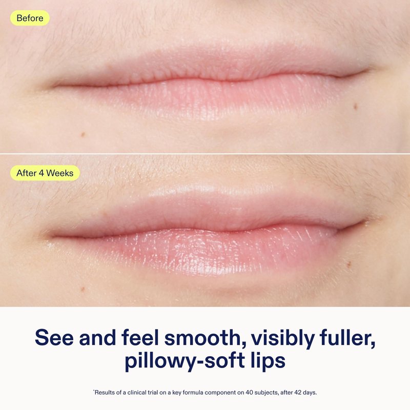 Skinfix Triple Lipid Lip Treatment - 0.27 oz - Hydrating, Volumizing Balm - Visibly Smooths Fine Lines - Fragrance Free - Vegan, Cruelty Free