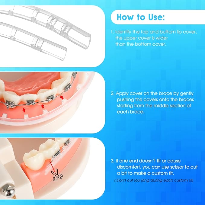Comfort Covers for Braces - Orthodontic Mouth Guard, Lip Protector, Wax Alternative, Lip Shield for Brackets