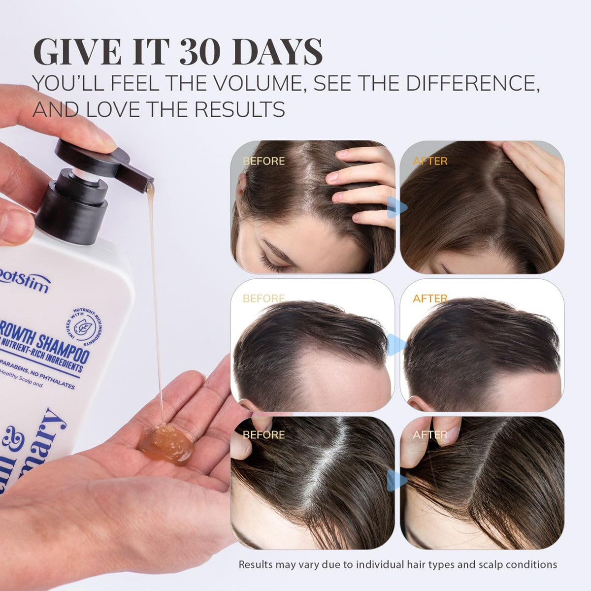 RootStim Biotin & Rosemary Shampoo for Hair Growth - Hair Loss Shampoo with Saw Palmetto Ginger Caffine Supports Thicker-Looking Hair Sulfate Free 10 fl oz Each, Pack of 2