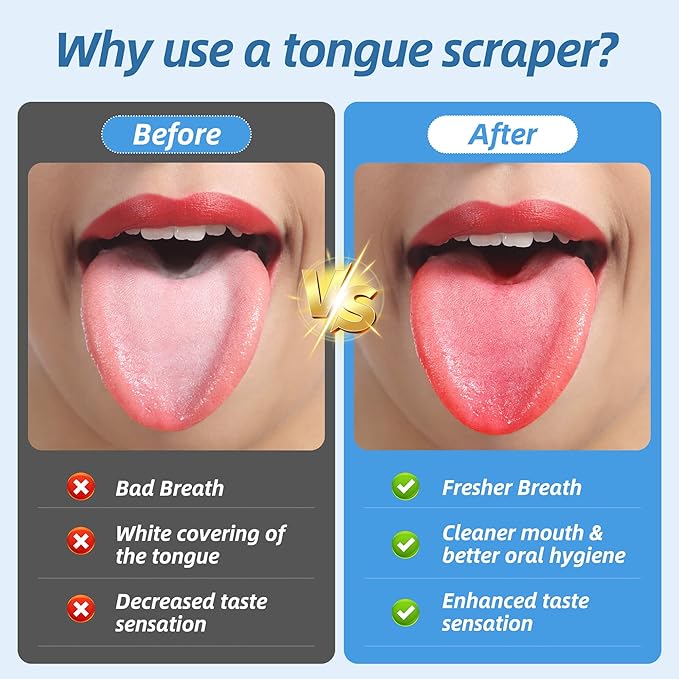 6 Pack Tongue Scraper - Reusable & Easy to Clean Tongue Scrubber with Travel Case for Adults & Kids - Medical-Grade 100% Stainless Steel Tongue Cleaner for Fresh Breath & Oral Care