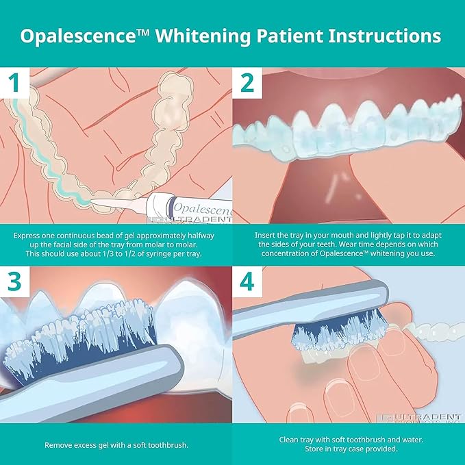 Opalescence 35% Gel Syringes Teeth Whitening - Refill Kit (12 Syringes), Made by Ultradent, Carbamide Peroxide in Mint Flavor. Tooth Whitening 5197-12